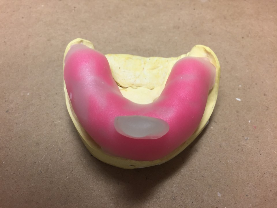 A custom tray hack using PlayDoh Mouthing Off Blog of the American